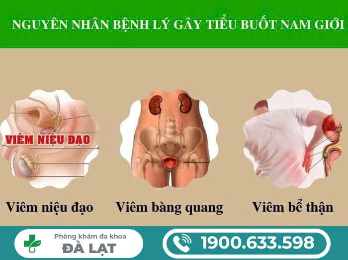 Hình ảnh minh họa